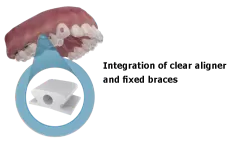 ハイブリッドセラピー