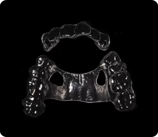 前部のproclinationを避ける