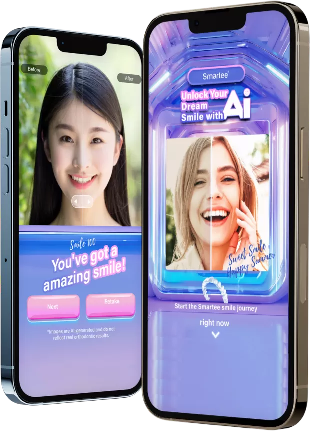 AI搭載のスマイルプレビュー