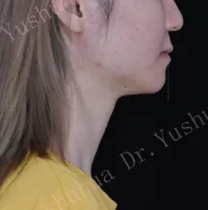 治療前の顔の写真