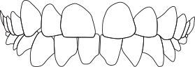 間隔