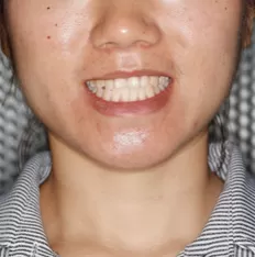 治療前の顔の写真
