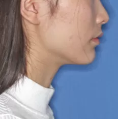 治療前の顔の写真
