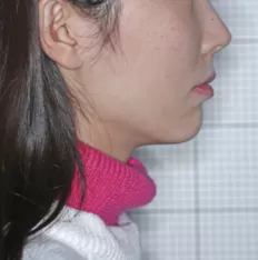 治療前の顔の写真