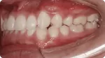 患者の基本情報と検査
