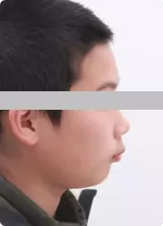 患者の基本情報と検査