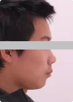 患者の基本情報と検査