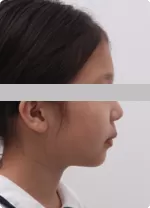 患者の基本情報と検査